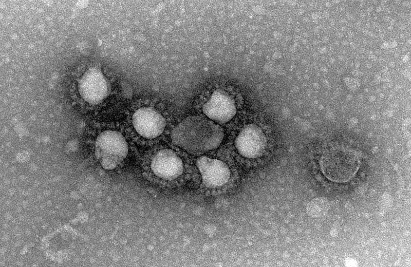 Elektronenmikroskopische Aufnahme des SARS-COV-2-Virus.