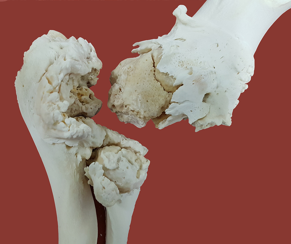 Großaufnahme von zwei weißen Knochen auf roter Unterlage. Dargestellt ist das Ellbogengelenk eines Schweines mit chronischer Entzündung, die Gelenkflächen sind komplett zerstört.